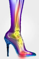 High Heels Cause Ball of Foot Pain