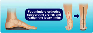 Orthotics by Footminders®-Effective Relief for Plantar Fasciitis -Flat ...